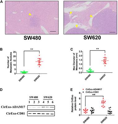 Exosome-Derived ADAM17 Promotes Liver Metastasis in Colorectal Cancer